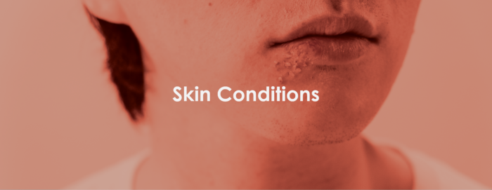 skin conditions treatment urgent care