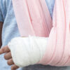 Can Urgent Care Treat Broken Bones?