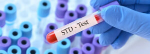 Does Urgent Care Clinics Do STD Testing?